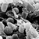Illustration for article titled A Few Mutant Genes Can Turn a Stomach Bug into the Black Death